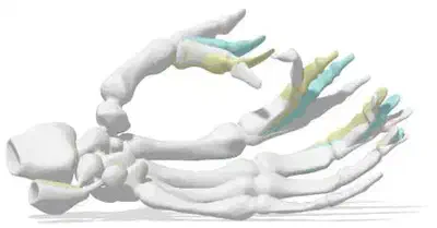 Example of parts of the shape moving in different directions at the same point